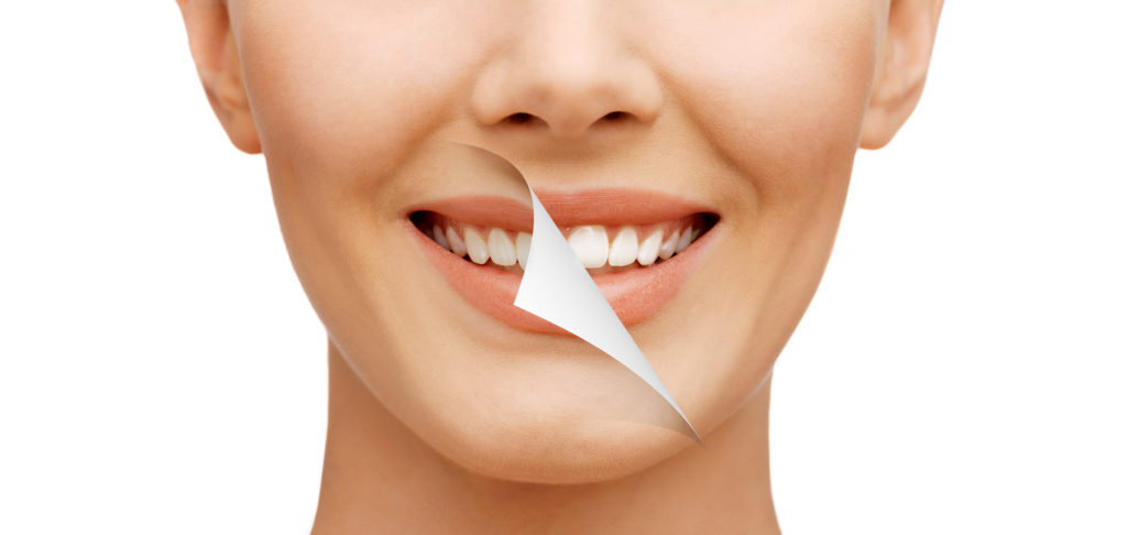 Wybielanie zębów można wykonać w gabinecie stomatologii estetycznej lub w domu